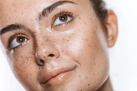 Pecas tatuadas: una tendencia.