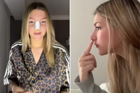 Jazmín Oltra se operó la nariz a los 16 años y dijo que se sacó un trauma