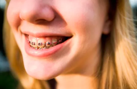 RXLIOCD2FJER5BXUYCZB2SJYLE.jpg